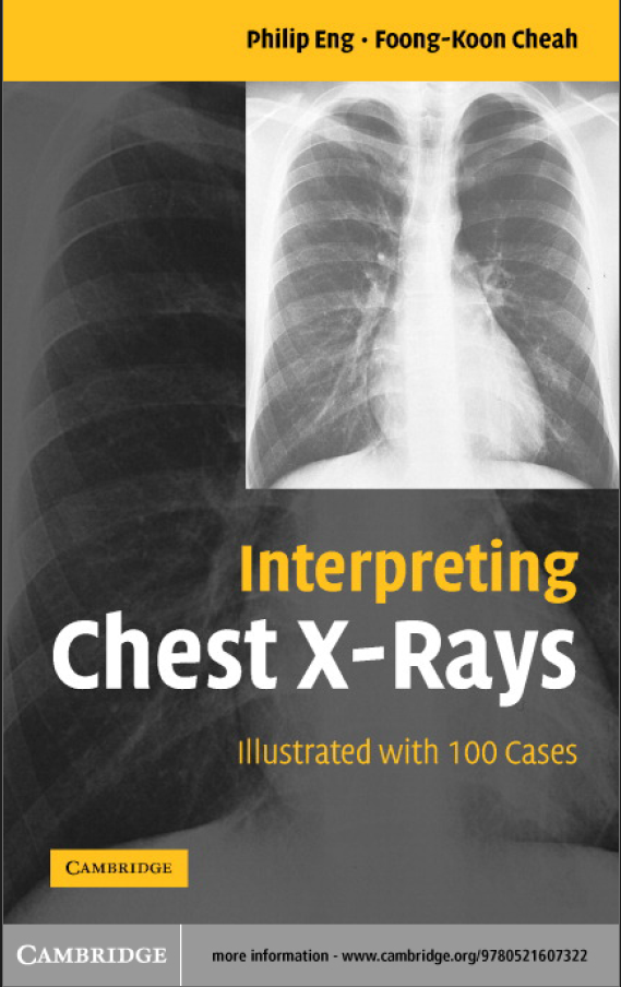 Interpreting Chest X-Rays [Illustrated]